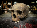 A human skull