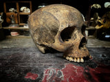 A human skull