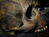 A human skull