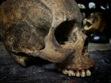 A human skull