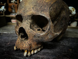 A human skull