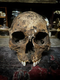 A human skull