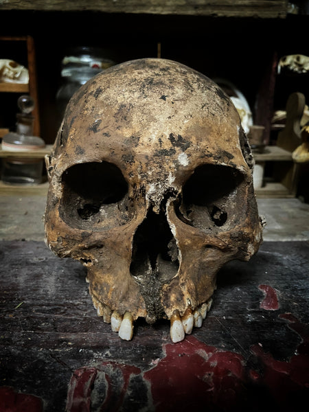 A human skull