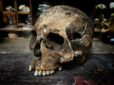 A human skull