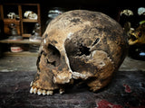 A human skull