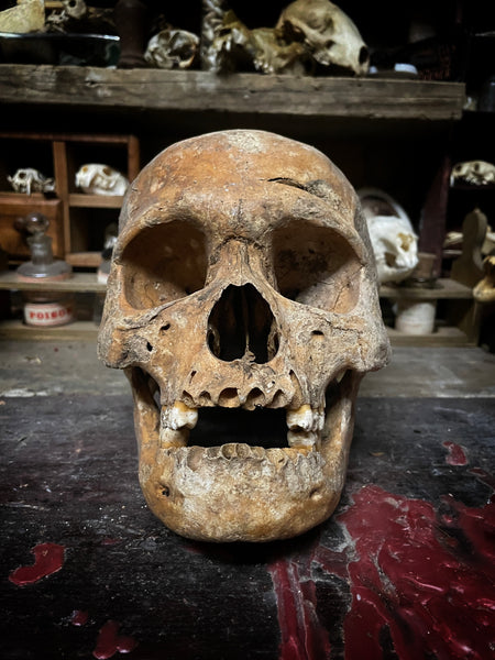 A human Skull with mandible