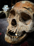 A human Skull with mandible