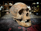 A human Skull with mandible