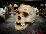A human Skull with mandible