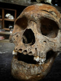 A human Skull with mandible
