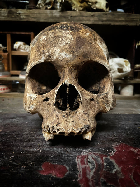 A human skull