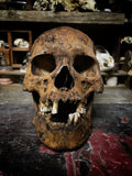 A human skull with mandible