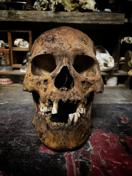 A human skull with mandible