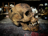 A human skull with mandible