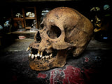 A human skull with mandible