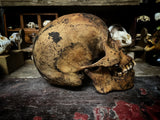 A human skull with mandible