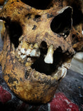 A human skull with mandible