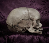 Fetal skull
