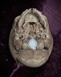 Fetal skull