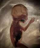 Fetal specimen