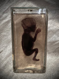 Fetal specimen